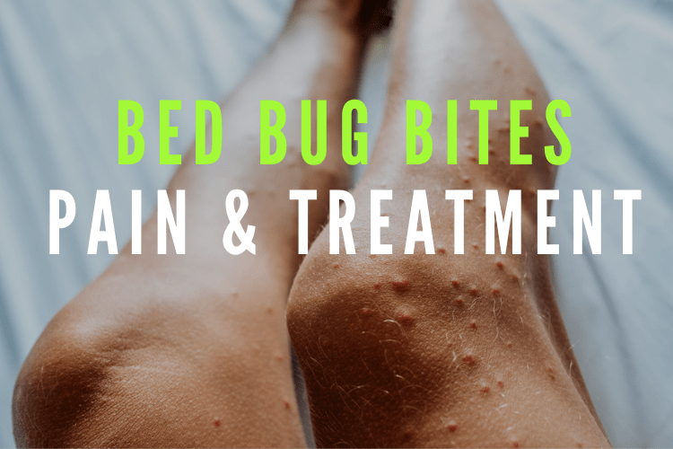 Bed Bug Bites Pain & Treatment-min